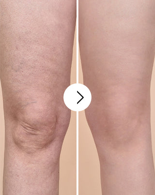 Tabletten voor cellulitis en het verbeteren van de huidconditie met natuurlijke extracten, Cellinea 60 capsules_4 - 4