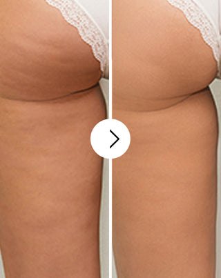 Tabletten voor cellulitis en het verbeteren van de huidconditie met natuurlijke extracten, Cellinea 60 capsules_2 - 2