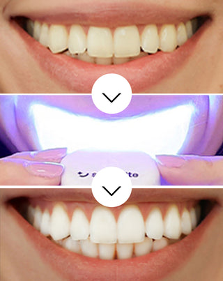 Smilebite Light & Bright Tandenbleekset LED-lamp + Whitesmile Serum™ - 3